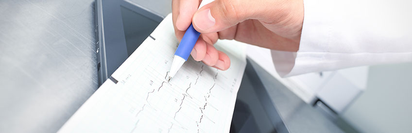 EKG technician marking readout with pen